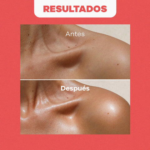 Combo Facial Rosas Balance | Jabón + Agua + Nutripiel + Aceite de 120 ml GRATIS
