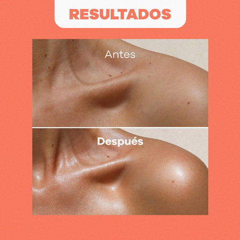 Combo Facial Arroz Control Brillo | Agua Facial + Crema + Nutripiel + Aceite Almendras 120 ml GRATIS