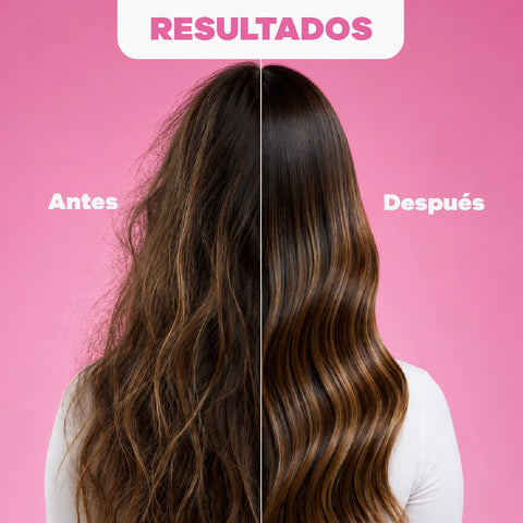 ONIONVITAL Sérum  - gotas para el cabello (60 ml/2.02 FlOz)